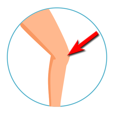 Rodilla