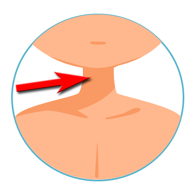 Cuello